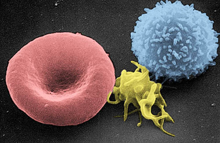 Rote Blutkörperchen und Lymphozyten - Elektronenmicroscopiefaciliteit van het National Cancer Institute in Frederick (NCI-Frederick), Publiek domein, via Wikimedia Commons