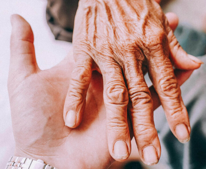 Een hand van iemand die aan artritis lijdt