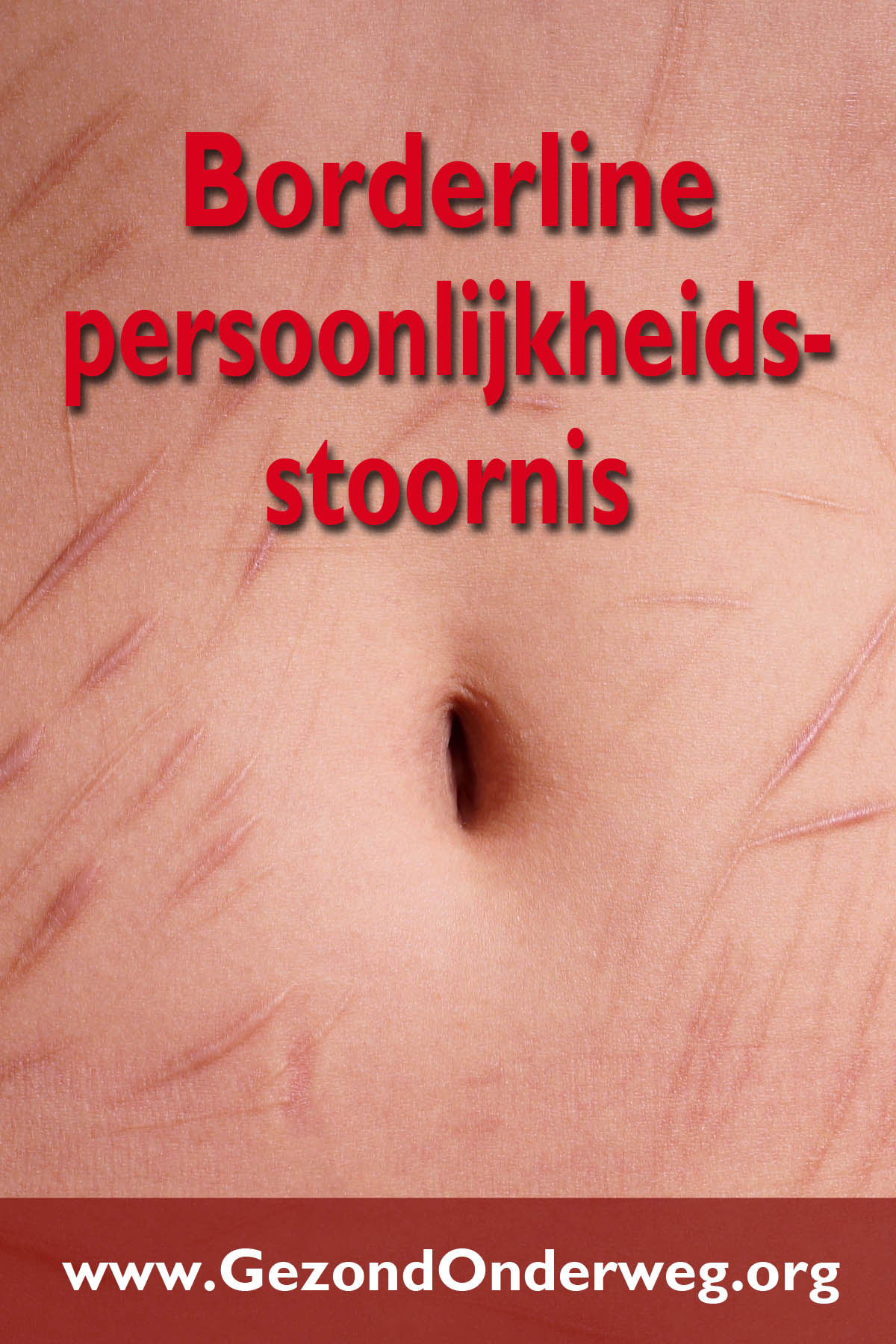 Borderline-persoonlijkheidsstoornis